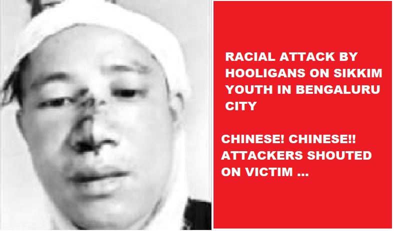 Shouting ‘Chinese, Chinese’ Miscreants Brutally Assaults Innocent Sikkim Man In Bengaluru City