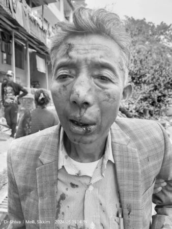 Ex-Speaker KN Rai Victim of Savage Assault in Melli, South Sikkim ; SDF demands President's Rule