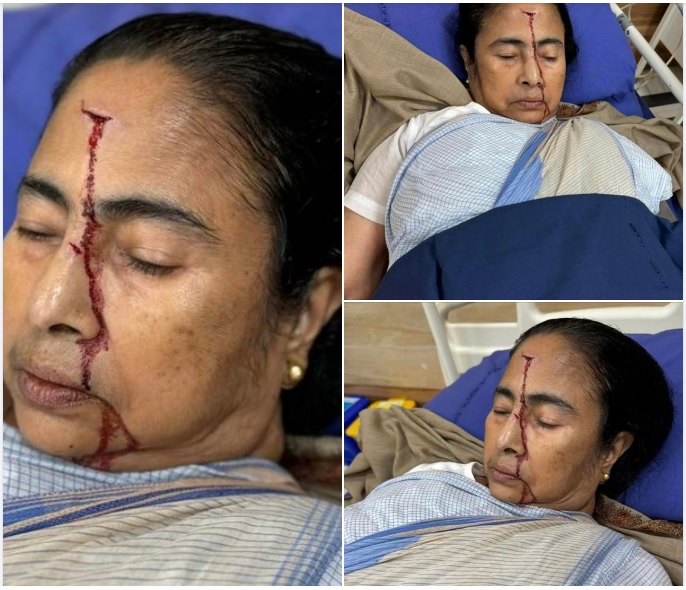 WB CM Mamata Banerjee Discharged From Hospital With Health Advisory