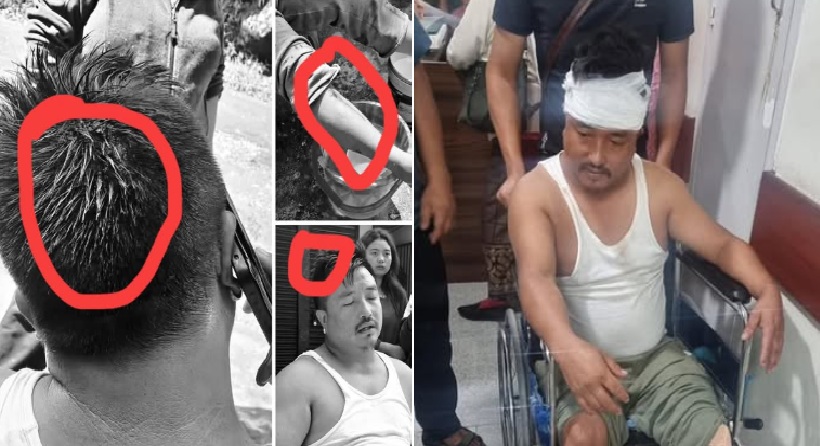 CAP Condemns Brutal Attack on Leader Ashish Rai, Calls It a Blow to Democracy